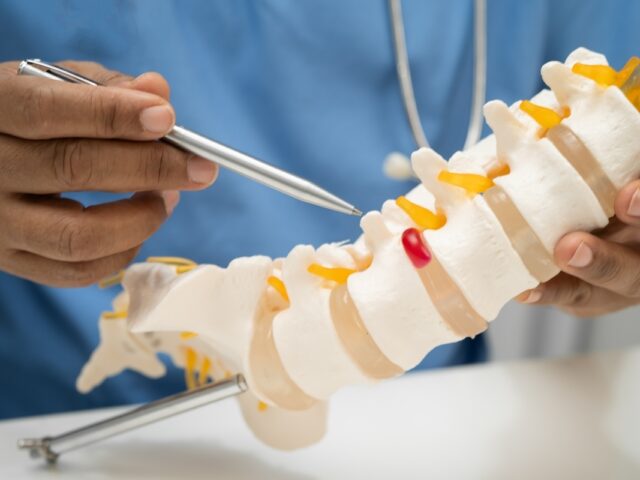 Can Chiropractic Therapy Help With a Disc Herniation From a Crash?